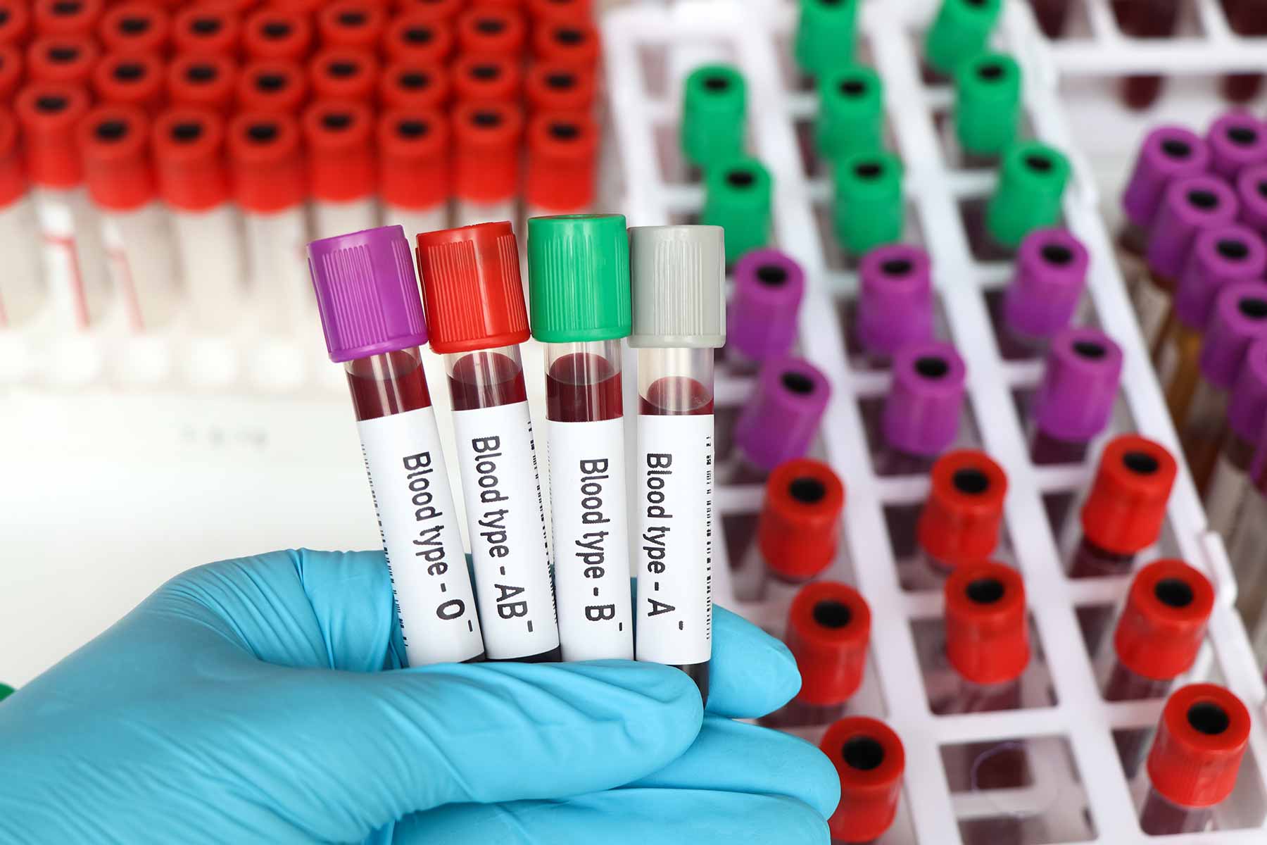 Close-up of a medical technologist’s gloved hand holding a blood sample for blood type testing