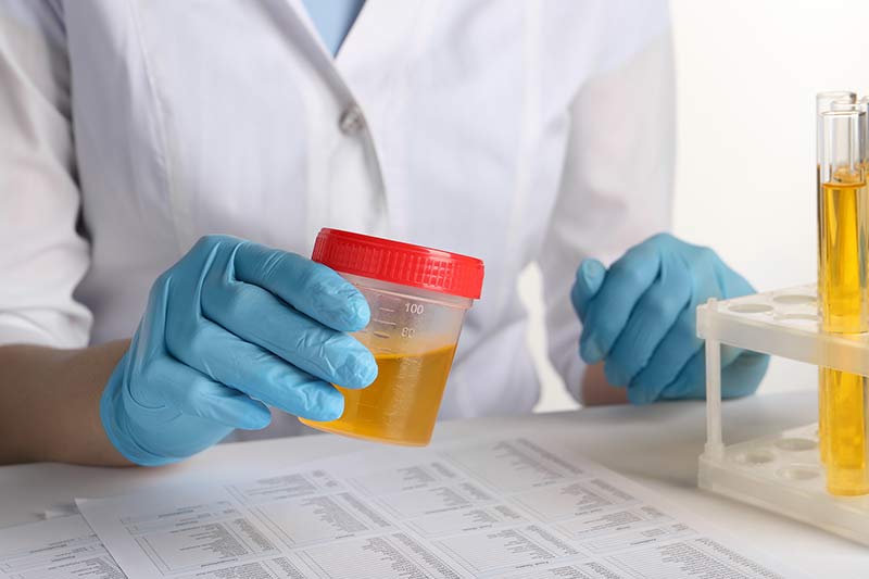 Urinalysis cost