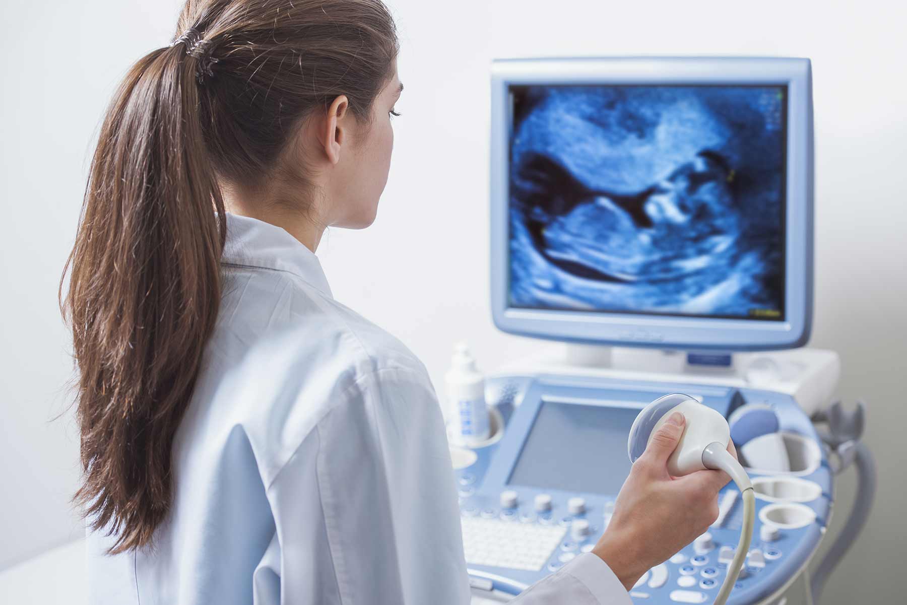 A female doctor reviews ultrasound results on a monitor A female doctor reviews ultrasound results on a monitor